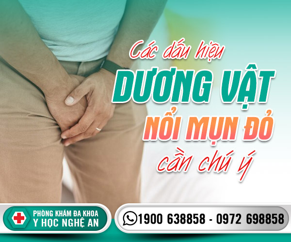 Các dấu hiệu dương vật nổi mụn đỏ cần chú ý