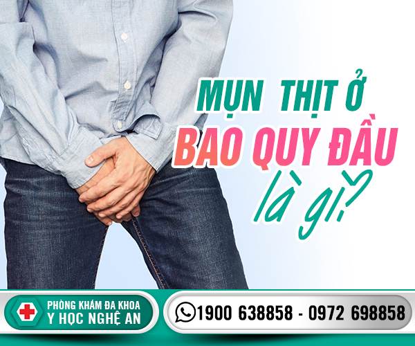 Mụn thịt ở bao quy đầu
