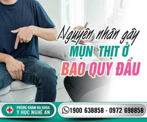 Nguyên nhân mụn thịt ỏ bao quy đầu